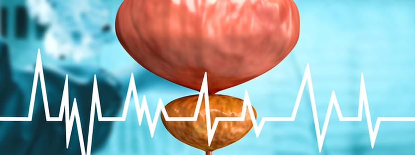 Dá sa liečiť zväčšená prostata?