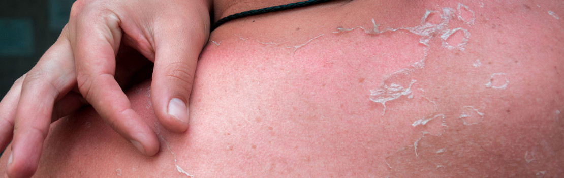 co-robit-ked-sa-dostavi-upal-pomoze-aj-zinok